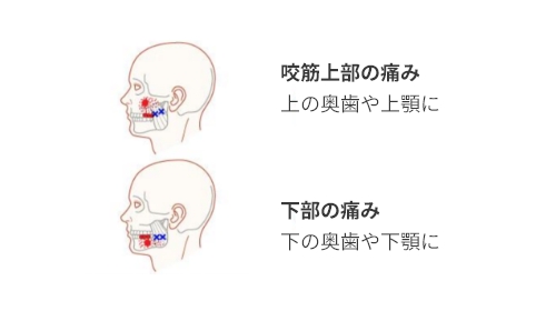咬筋(こうきん)